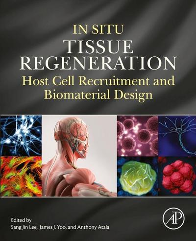 In Situ Tissue Regeneration