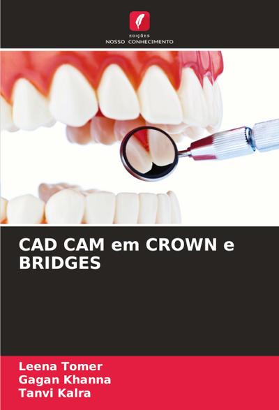 CAD CAM em CROWN e BRIDGES