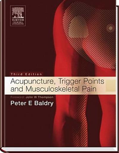 Acupuncture, Trigger Points and Musculoskeletal Pain