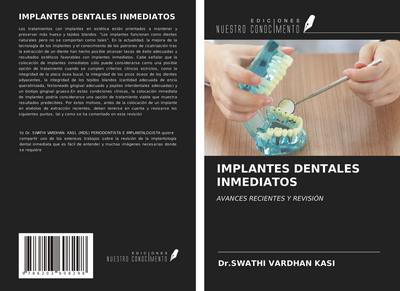 IMPLANTES DENTALES INMEDIATOS