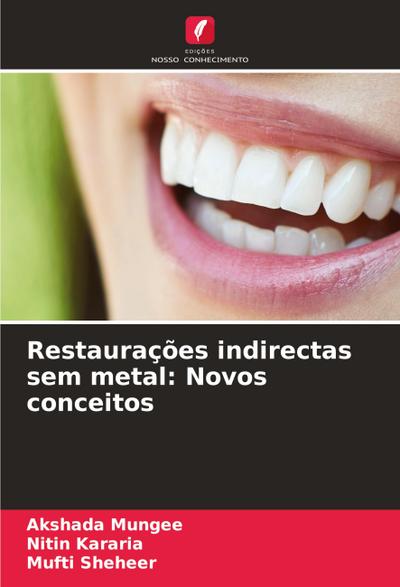 Restaurações indirectas sem metal: Novos conceitos
