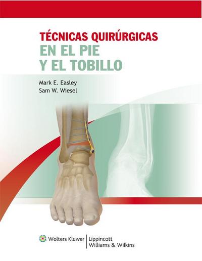 Técnicas quirúrgicas en pie y tobillo