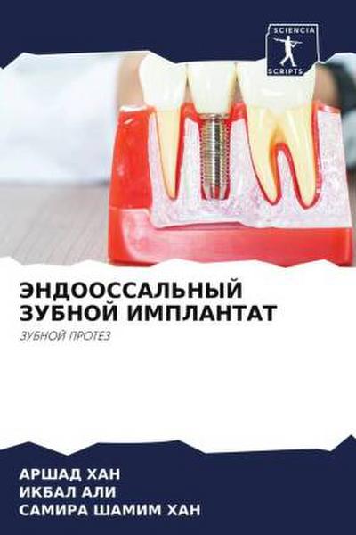 JeNDOOSSAL’NYJ ZUBNOJ IMPLANTAT