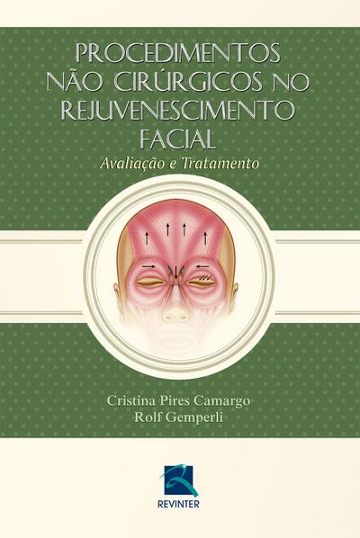 Procedimentos não Cirúrgicos no Rejuvenescimento Facial