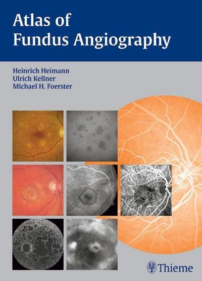 Atlas of Angiography of the Optic Fundus