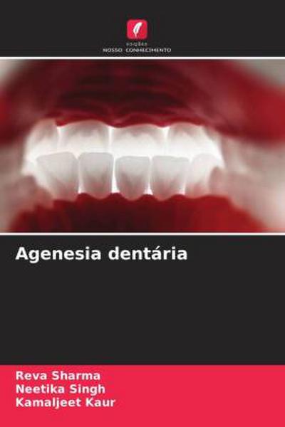 Agenesia dentária