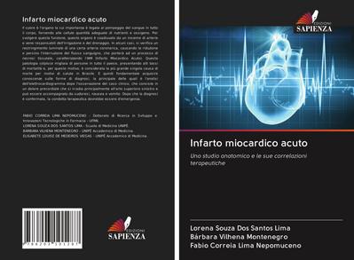 Infarto miocardico acuto