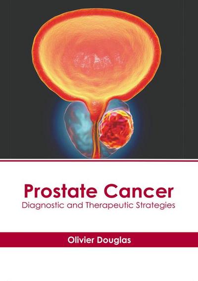 Prostate Cancer: Diagnostic and Therapeutic Strategies