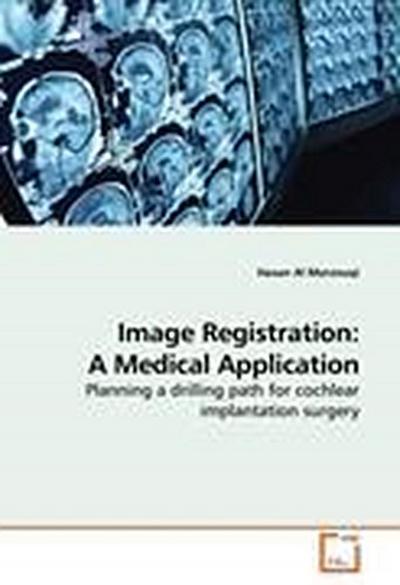 Image Registration: A Medical Application
