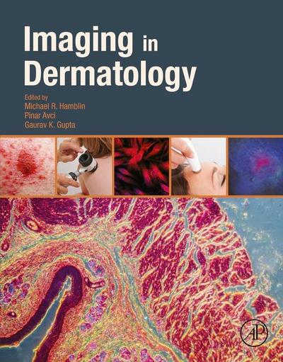 Imaging in Dermatology