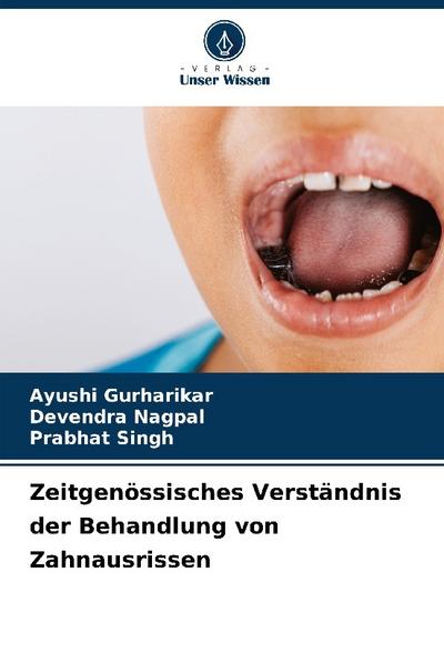 Zeitgenössisches Verständnis der Behandlung von Zahnausrissen