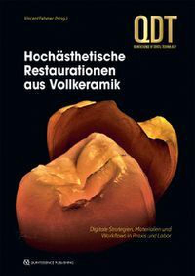 Hochästhetische Restaurationen aus Vollkeramik