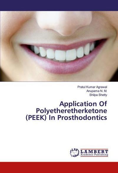 Application Of Polyetheretherketone (PEEK) In Prosthodontics