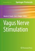Vagus Nerve Stimulation