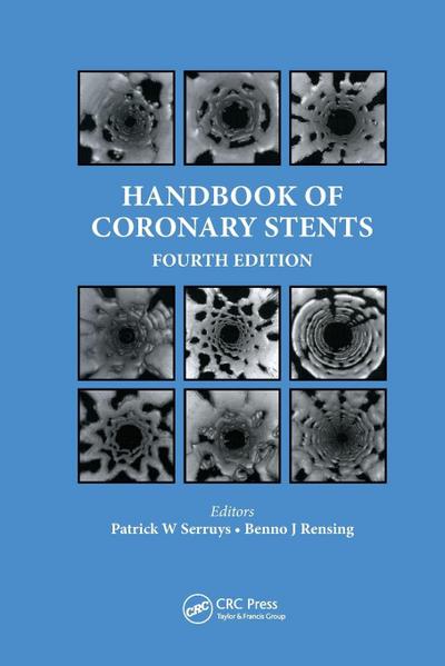 Handbook of Coronary Stents