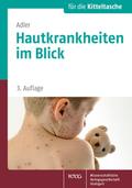 Hautkrankheiten im Blick