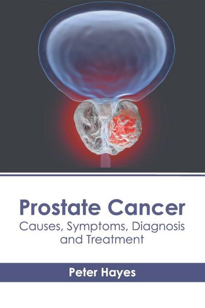 Prostate Cancer: Causes, Symptoms, Diagnosis and Treatment