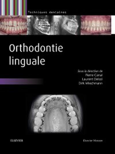 Orthodontie linguale