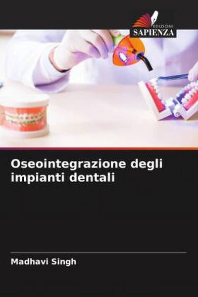 Oseointegrazione degli impianti dentali