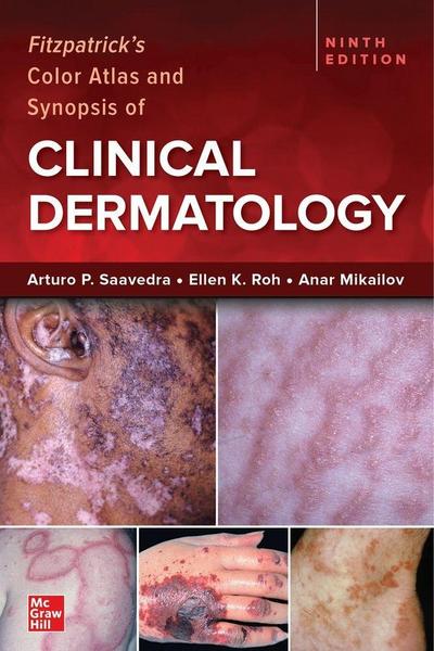 Fitzpatrick’s Color Atlas and Synopsis of Clinical Dermatology, Ninth Edition