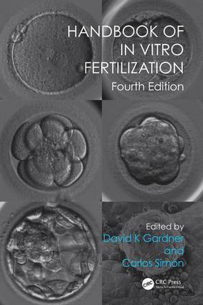 Handbook of in Vitro Fertilization