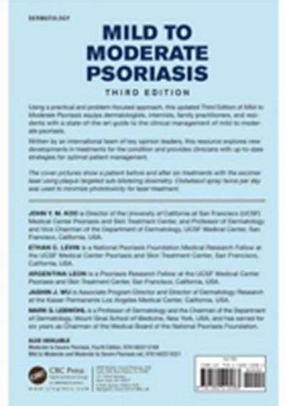 Mild to Moderate Psoriasis