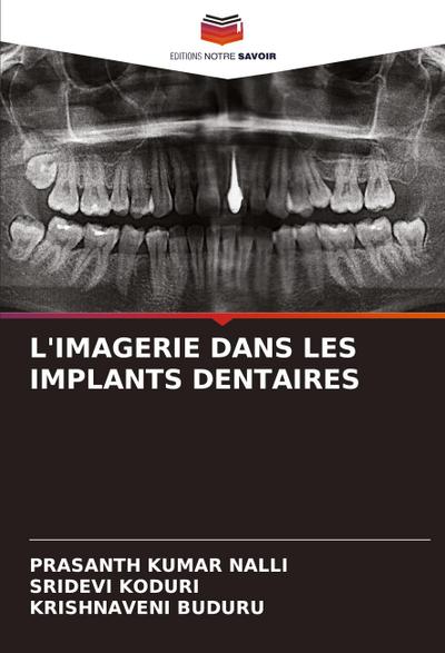L’IMAGERIE DANS LES IMPLANTS DENTAIRES