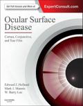 Ocular Surface Disease: Cornea, Conjunctiva and Tear Film E-Book
