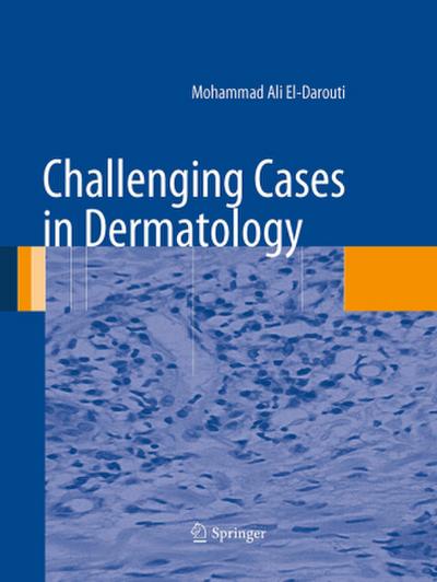 Challenging Cases in Dermatology