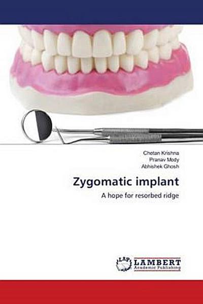 Zygomatic implant