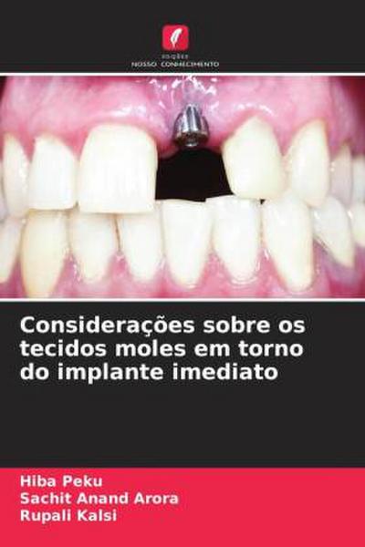 Considerações sobre os tecidos moles em torno do implante imediato