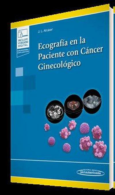 Ecografía en la Paciente con Cáncer Ginecológico (+ e-book)