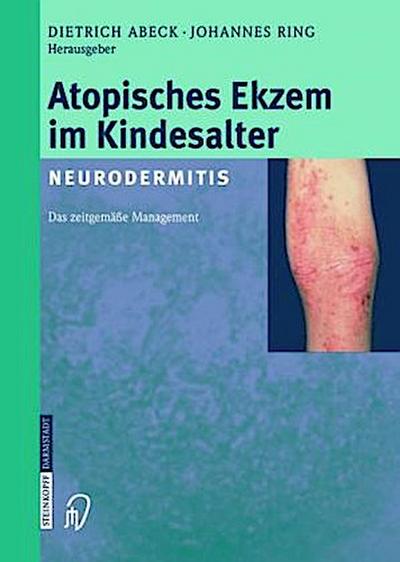 Atopisches Ekzem im Kindesalter (Neurodermitis)