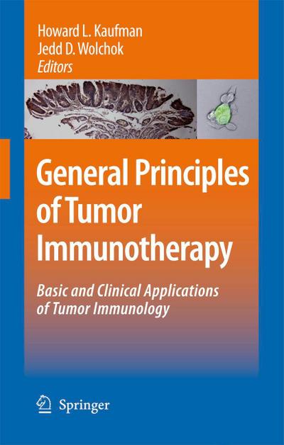 General Principles of Tumor Immunotherapy