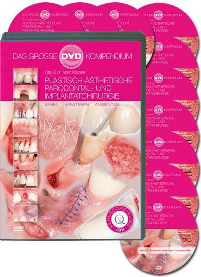 Plastisch-Ästhetische Parodontal- und Implantatchirurgie