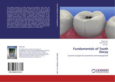 Fundamentals of Tooth Decay