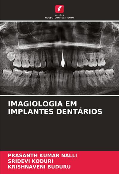IMAGIOLOGIA EM IMPLANTES DENTÁRIOS