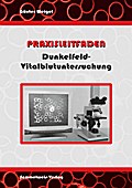 Dunkelfeld-Vitalblutuntersuchung