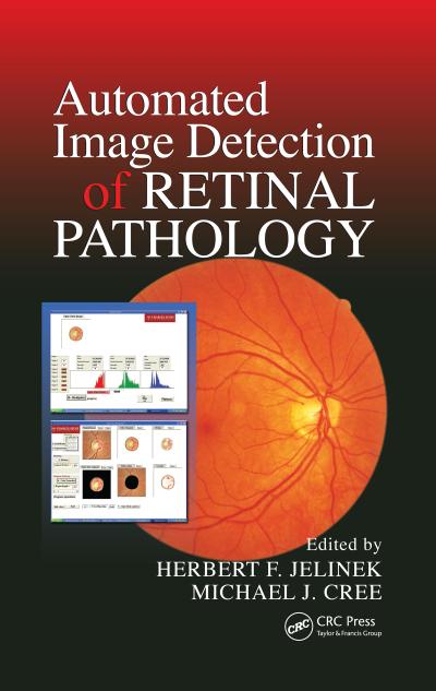 Automated Image Detection of Retinal Pathology