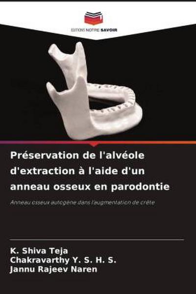 Préservation de l’alvéole d’extraction à l’aide d’un anneau osseux en parodontie