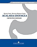 Acalasia esofagea