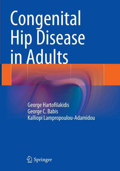 Congenital Hip Disease in Adults