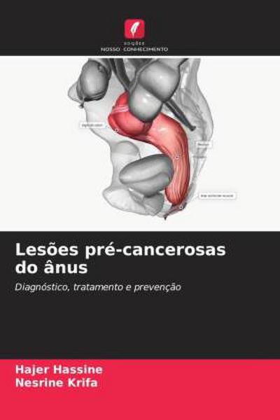 Lesões pré-cancerosas do ânus