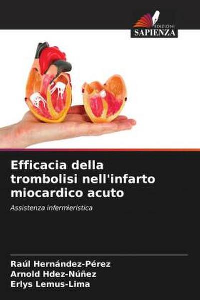 Efficacia della trombolisi nell’infarto miocardico acuto
