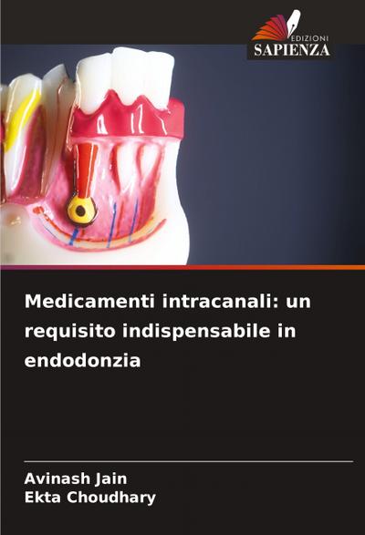 Medicamenti intracanali: un requisito indispensabile in endodonzia