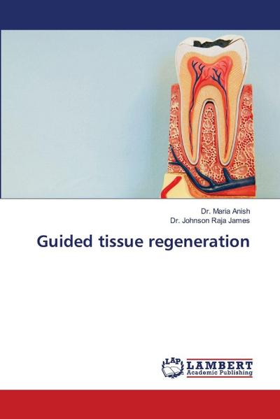 Guided tissue regeneration