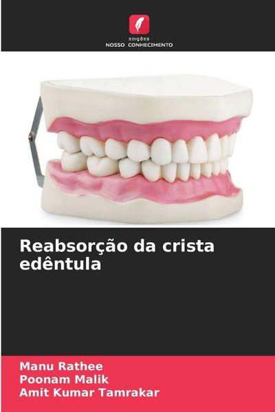 Reabsorção da crista edêntula
