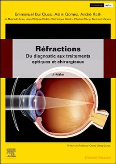 Refractions