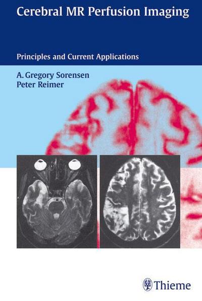 Cerebral MR Perfusion Imaging