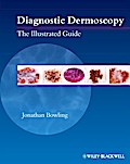 Diagnostic Dermoscopy